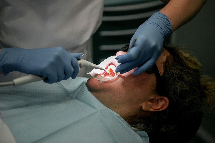 Лечение кист зубов